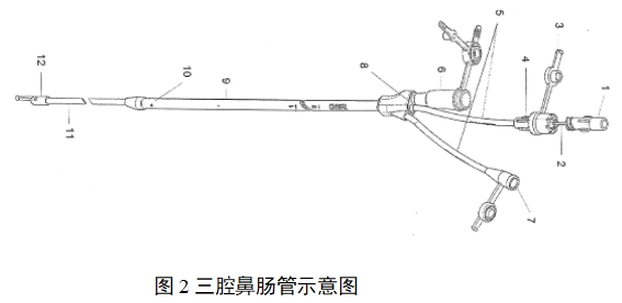 經(jīng)鼻腸營養(yǎng)導(dǎo)管注冊(cè)審查指導(dǎo)原則（2022年第41號(hào)）(圖2)