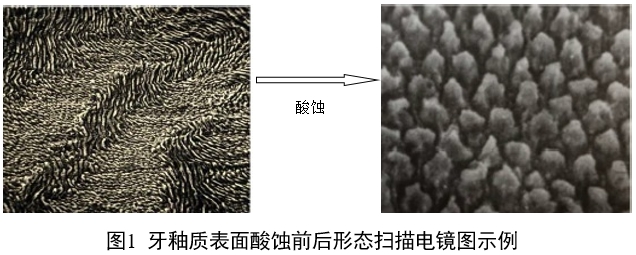 牙科用磷酸酸蝕劑注冊審查指導(dǎo)原則（2022年第41號）(圖1)