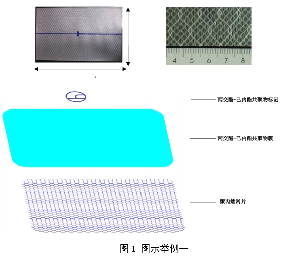 疝修補補片注冊審查指導(dǎo)原則（2023年修訂版）（2023年第9號）(圖4)