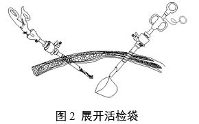 一次性使用內(nèi)窺鏡用活檢袋注冊審查指導(dǎo)原則(2025年第20號(hào))(圖2) 一次性使用內(nèi)窺鏡用活檢袋注冊審查指導(dǎo)原則(2025年第20號(hào))(圖2)