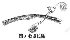 一次性使用內(nèi)窺鏡用活檢袋注冊審查指導(dǎo)原則(2025年第20號(hào))(圖3) 一次性使用內(nèi)窺鏡用活檢袋注冊審查指導(dǎo)原則(2025年第20號(hào))(圖3)