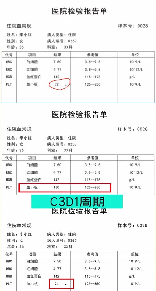 AE與研究藥物關(guān)系記錄不一致，如何處理？